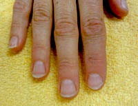 Naturnagelverstärkung vorher